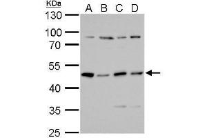 WB Image PKA R2 antibody detects PKA R2 protein by Western blot analysis. (PRKAR2A Antikörper  (Center))