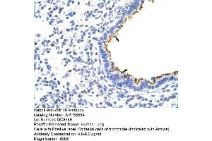 Human Lung (ZNF16 Antikörper  (N-Term))