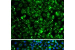Immunofluorescence analysis of MCF-7 cells using TMLHE Polyclonal Antibody (TMLHE Antikörper)