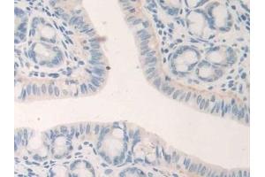 Immunohistochemistry (IHC) image for anti-Growth Differentiation Factor 5 (GDF5) (AA 358-495) antibody (ABIN7437095)
