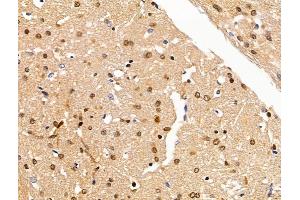 ABIN7094648 and ABIN7098699 at 1/100 staining Rat brain tissue by IHC-P.