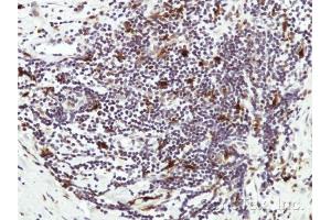 IHC-P Image Immunohistochemical analysis of paraffin-embedded Human lymph tissue, using HICE1 , antibody at 1:50 dilution. (NYS48/HAUS8 Antikörper)