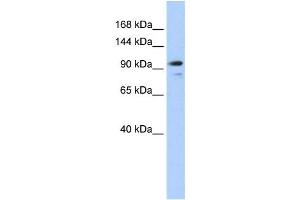 Western Blotting (WB) image for anti-Angiomotin Like 1 (AMOTL1) antibody (ABIN2458691) (AMOTL1 Antikörper)