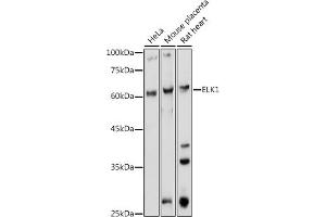 Western blot analysis of extracts of various cell lines, using ELK1 antibody (ABIN1679704, ABIN3015328, ABIN3015329 and ABIN6213987) at 1:1000 dilution. (ELK1 Antikörper  (AA 90-250))