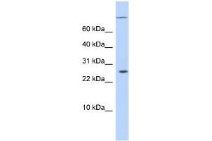 WB Suggested Anti-ARID5A Antibody Titration:  0. (ARID5A Antikörper  (N-Term))