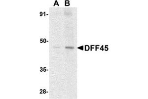 Western Blotting (WB) image for anti-DNA Fragmentation Factor, 45kDa, alpha Polypeptide (DFFA) (N-Term) antibody (ABIN1031352) (DFFA Antikörper  (N-Term))