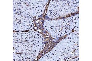 IHC analysis of Beclin 1 using anti-Beclin 1 antibody (ABIN7599303).
