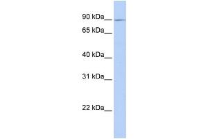 WB Suggested Anti-XYLT2 Antibody Titration:  0. (XYLT2 Antikörper  (C-Term))