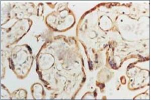 Image no. 1 for anti-Superoxide Dismutase 1, Soluble (SOD1) antibody (ABIN264856) (SOD1 Antikörper)