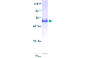 FANCA Protein (AA 1-297) (GST tag)