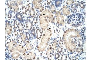 ANP32A antibody was used for immunohistochemistry at a concentration of 4-8 ug/ml to stain Epithelial cells of renal tubule (arrows) in Human Kidney.