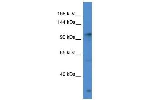 Western Blot showing GABBR2 antibody used at a concentration of 1 ug/ml against Hela Cell Lysate (GABBR2 Antikörper  (C-Term))