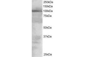 Western Blotting (WB) image for Vav 2 Guanine Nucleotide Exchange Factor (VAV2) peptide (ABIN370136) (Vav 2 Guanine Nucleotide Exchange Factor (VAV2) Peptid)