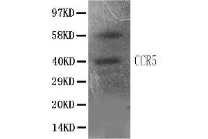 Anti-CCR5 antibody, IHC(P)All lanes: Anti CCR5  at 0. (CCR5 Antikörper  (N-Term))