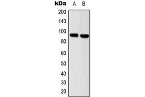 Western blot analysis of STAT5 expression in HeLa (A), A431 (B) whole cell lysates. (STAT5A Antikörper  (Center))
