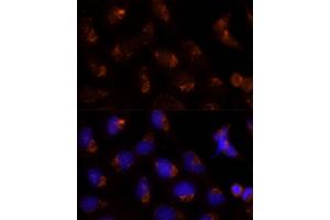 Immunofluorescence analysis of U-2 OS cells using SEC14L2 Polyclonal Antibody (ABIN6132639, ABIN6147484, ABIN6147485 and ABIN6214889) at dilution of 1:100 (40x lens).