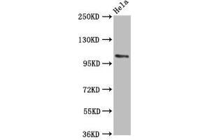 Western Blot Positive WB detected in: Hela whole cell lysate All lanes: PAM antibody at 5. (PAM Antikörper  (AA 338-497))