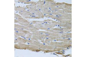 Immunohistochemistry of paraffin-embedded rat heart using TARS antibody (ABIN5974207) at dilution of 1/100 (40x lens). (TARS Antikörper)
