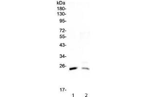 Western blot testing of 1) rat testis and 2) mouse testis lysate with StAR antibody at 0. (STAR Antikörper)