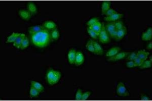 anti-Coiled-Coil Domain Containing 37 (CCDC37) (AA 1-300) antibody
