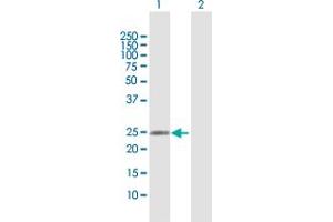 Western Blot analysis of RAB37 expression in transfected 293T cell line by RAB37 MaxPab polyclonal antibody. (RAB37 Antikörper  (AA 1-223))