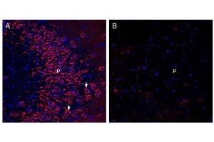 Expression of Neuronal Pentraxin Receptor in rat hippocampus. (NPTXR Antikörper  (C-Term, Extracellular))