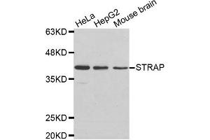 Western Blotting (WB) image for anti-Serine/threonine Kinase Receptor Associated Protein (STRAP) antibody (ABIN1876993) (STRAP Antikörper)