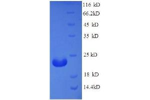 Adiponectin, C1Q and Collagen Domain Containing (ADIPOQ) (AA 18-247), (full length) protein (His tag)