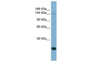 WB Suggested Anti-JARID2 Antibody Titration: 0. (JARID2 Antikörper  (N-Term))