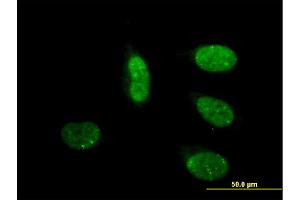 Immunofluorescence of monoclonal antibody to CRSP6 on HeLa cell.