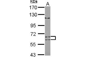 Western Blotting (WB) image for anti-Adenosine Deaminase Domain Containing 1 (Testis-Specific) (ADAD1) (AA 1-307) antibody (ABIN1496470) (ADAD1 Antikörper  (AA 1-307))