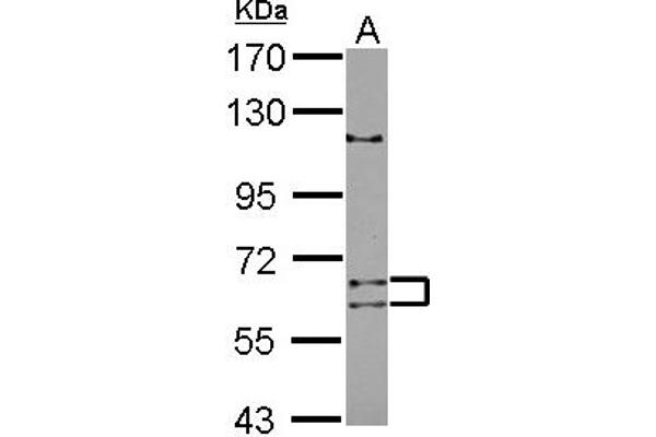 ADAD1 Antikörper  (AA 1-307)