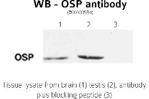 Image no. 2 for anti-Claudin 11 (CLDN11) (C-Term) antibody (ABIN346949) (Claudin 11 Antikörper  (C-Term))