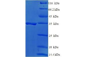 SDS-PAGE (SDS) image for DAN Domain Family, Member 5 (DAND5) (AA 23-189) protein (His-SUMO Tag) (ABIN4974551) (DAND5 Protein (AA 23-189) (His-SUMO Tag))