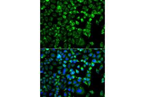 Immunofluorescence analysis of A549 cells using ZAK antibody. (ZAK Antikörper)