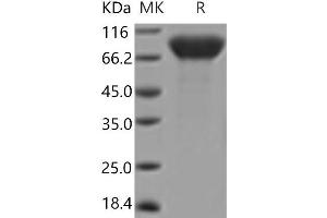 Western Blotting (WB) image for Colony Stimulating Factor 1 Receptor (CSF1R) (Active) protein (His tag) (ABIN7321076) (CSF1R Protein (His tag))