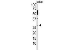 Image no. 1 for anti-Dickkopf 2 Homolog (DKK2) (C-Term) antibody (ABIN357070) (DKK2 Antikörper  (C-Term))