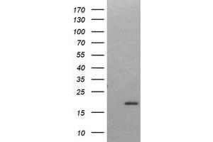 Image no. 1 for anti-LIM Domain Only 2 (Rhombotin-Like 1) (LMO2) antibody (ABIN1499188) (LMO2 Antikörper)