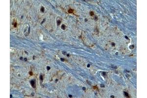 Immunohistochemistry (IHC) image for anti-Ionized Calcium-binding Adapter Molecule 1 (IBA1) (C-Term) antibody (ABIN184738)