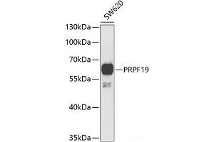 Western blot analysis of extracts of SW620 cells using PRPF19 Polyclonal Antibody at dilution of 1:1000. (PRP19 Antikörper)