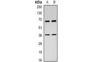 Western blot analysis of c-Rel expression in Hela (A), HEK293T (B) whole cell lysates. (c-Rel Antikörper  (C-Term))