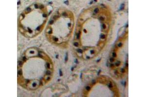 Used in DAB staining on fromalin fixed paraffin-embedded Kidney tissue (CAP1 Antikörper  (AA 38-149))