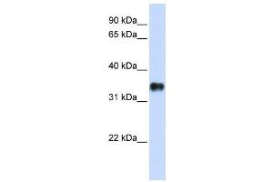 Western Blotting (WB) image for anti-Potassium Channel Tetramerisation Domain Containing 7 (KCTD7) antibody (ABIN2458146) (KCTD7 Antikörper)