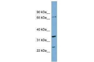PDP2 antibody used at 1 ug/ml to detect target protein. (PDP2 Antikörper  (Middle Region))