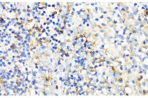 Immunohistochemistry of paraffin-embedded Human tonsil using ITGAX Polyclonal Antibody at dilution of 1:100 (40x lens). (CD11c Antikörper)