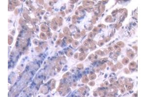 Immunohistochemistry (IHC) image for anti-Caspase 7, Apoptosis-Related Cysteine Peptidase (CASP7) (AA 1-250) antibody (ABIN1862282)