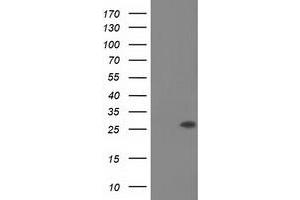 Western Blotting (WB) image for anti-OTU Domain, Ubiquitin Aldehyde Binding 2 (OTUB2) antibody (ABIN1499938)