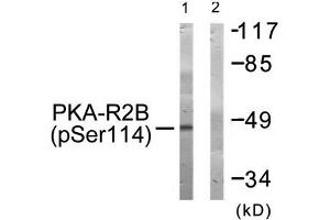 Western blot analysis of extracts from COS-7 cells treated with PMA using PKA-R2β (Phospho-Ser114) Antibody. (PRKAR2B Antikörper  (pSer113))