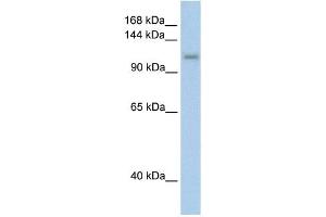 WB Suggested Anti-PRPF6 Antibody Titration:  2. (PRP6/ANT-1 Antikörper  (C-Term))