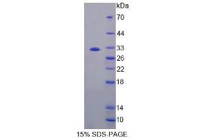 SDS-PAGE (SDS) image for Carboxylesterase 1 (CES1) (AA 31-286) protein (His tag) (ABIN6239161) (CES1 Protein (AA 31-286) (His tag))